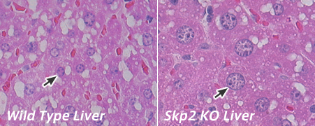 Wild Type Liver  Skp2 KO Liver
